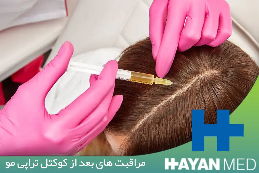 مراقبت های بعد از کوکتل تراپی مو